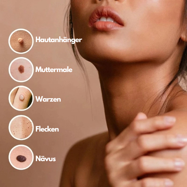 ClearSkinPro™ - Hauttag Entferner