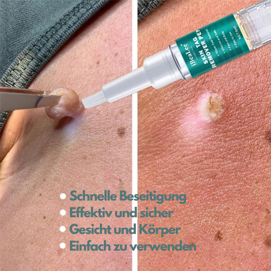 ClearSkinPro™ - Hauttag Entferner