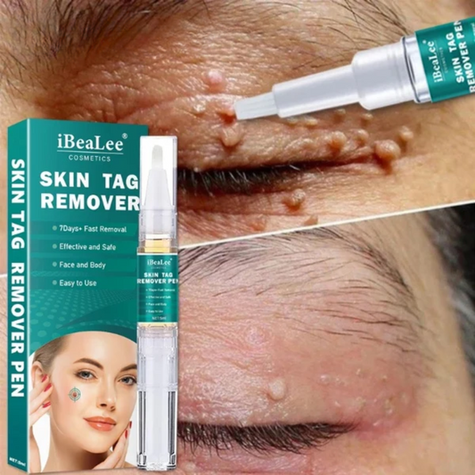 ClearSkinPro™ - Hauttag Entferner
